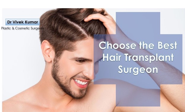 5 Tips Before Choosing the Best Hair Transplant Surgeon in Delhi