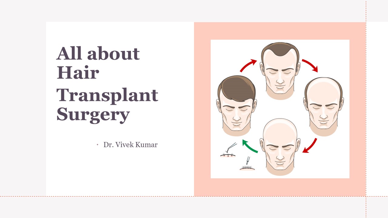 All about Hair Transplant Surgery