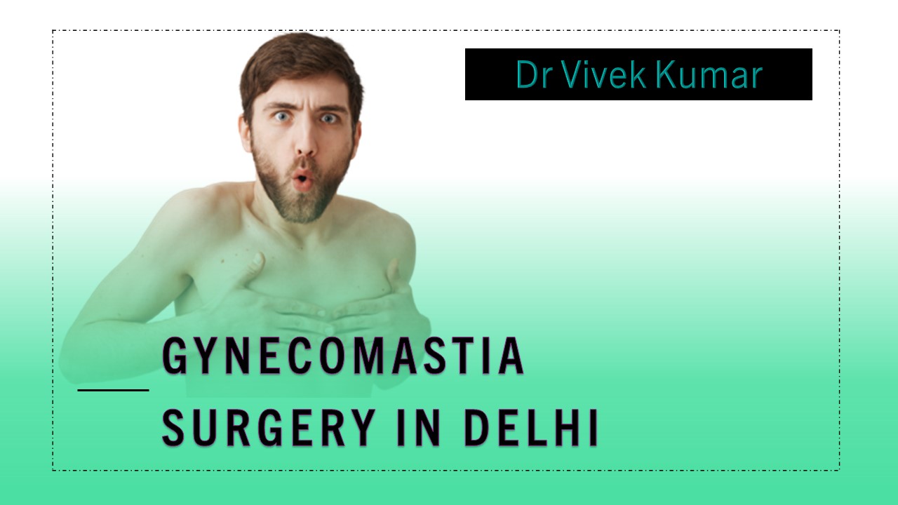 Gynecomastia Surgery and It's Cost in Delhi - A Complete Guide