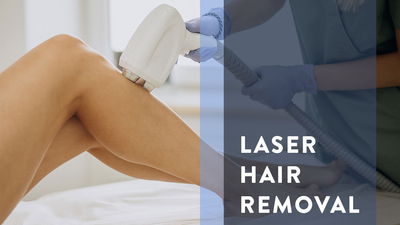 3 most important benefits of laser hair removal