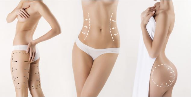 Reshape Specific areas of your Body through Liposuction Surgery